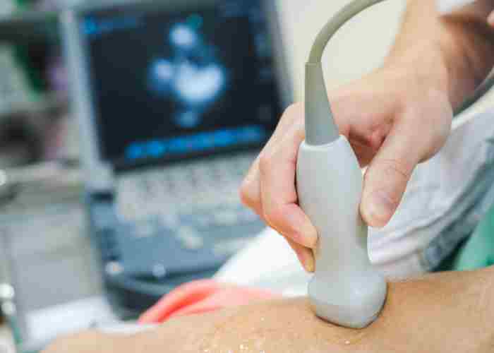 2d echo test in Hyderabad-DM heart care clinic, Attapur