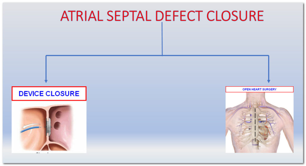 Atrial septal defect closure with either open heart surgery or device closure