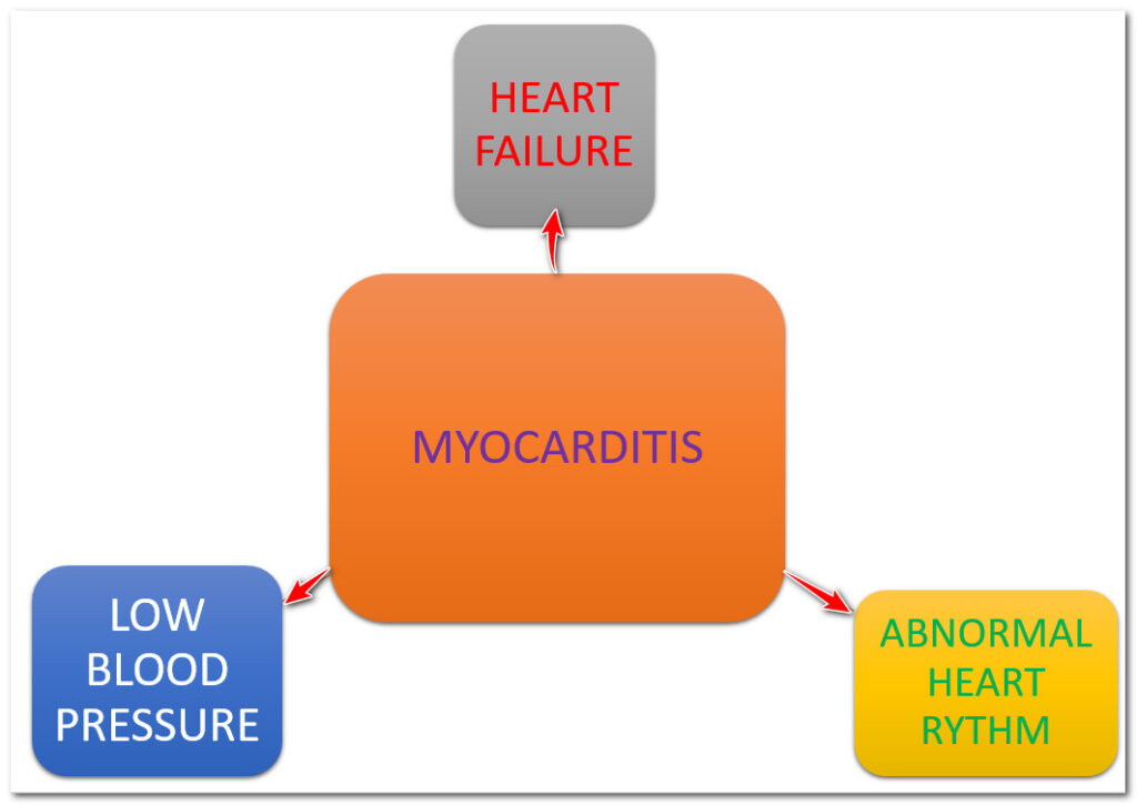 Covid-19 is causing myocarditis and damaging the heart
