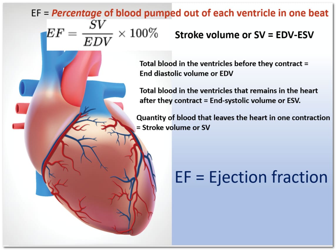 How to calculate ejection fraction