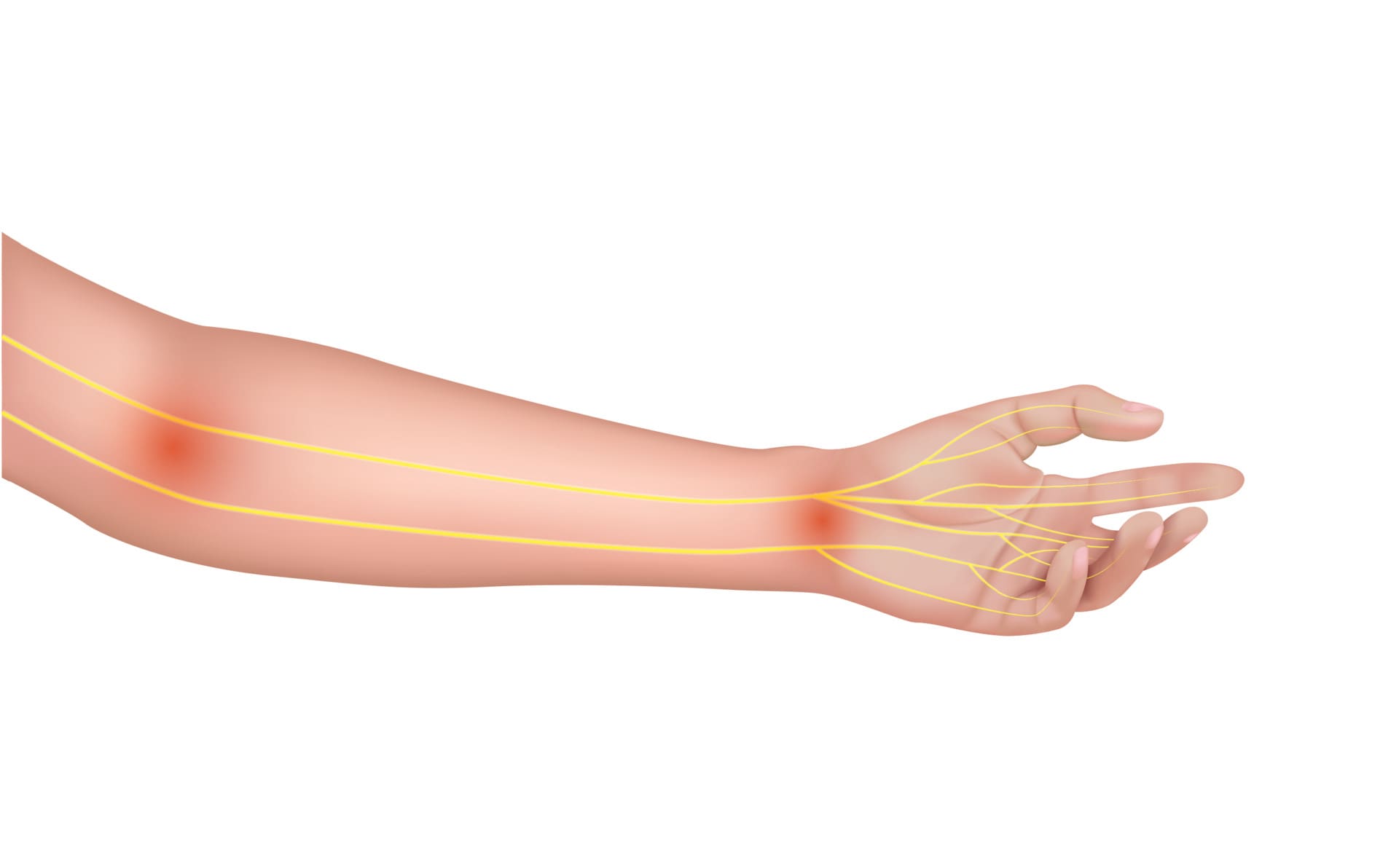 left-hand-pain-10-reasons-you-should-know