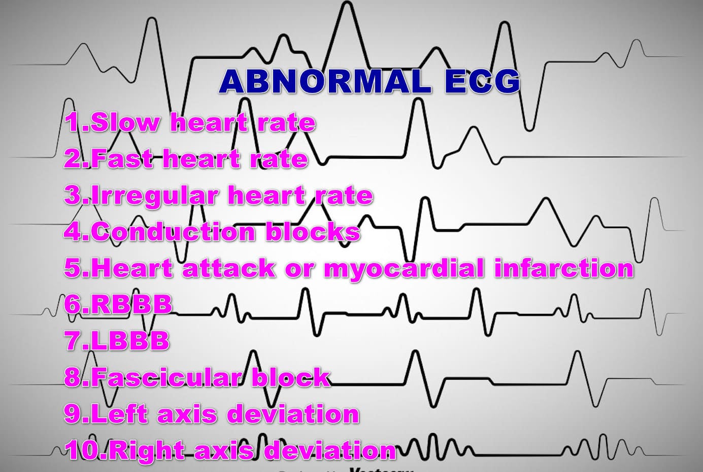 ABNORMAL electrocardiogram test