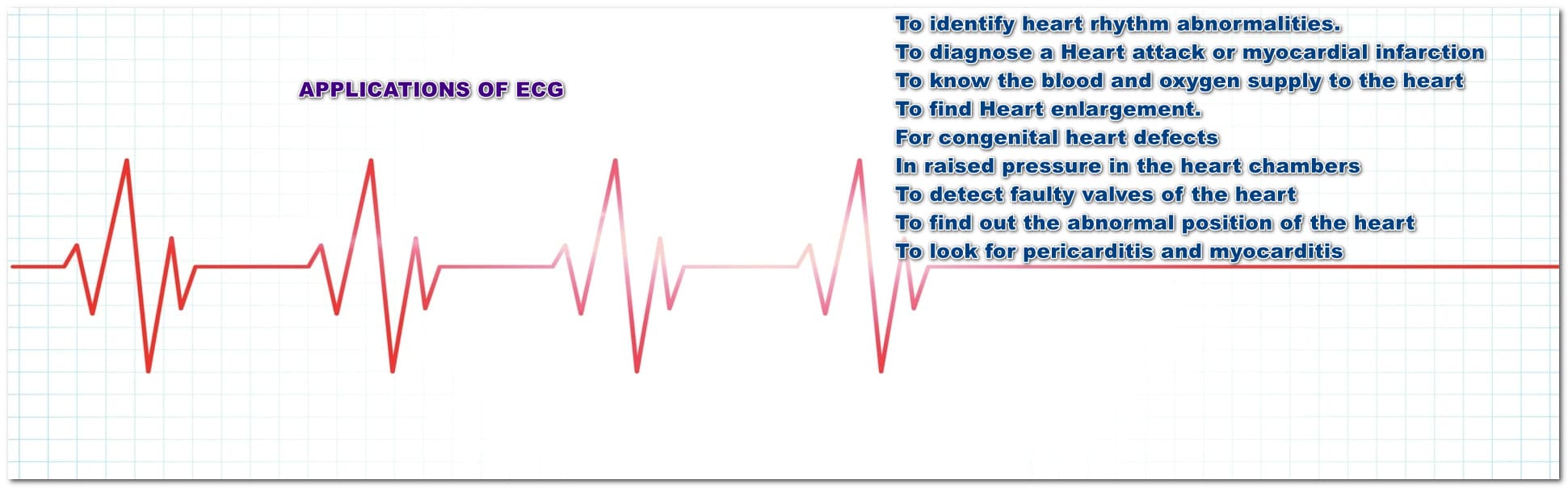 Uses of an ECG test