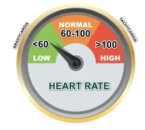 How low is bradycardia - heart rate less than 60 bpm