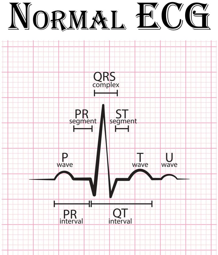 ELECTROCARDIOGRAM TEST IN TELANGANA - CARDIOLOGIST IN HYDERABAD FOR ECG ...