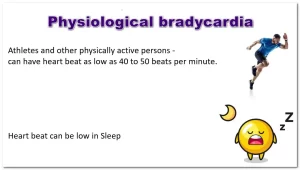  causes of physiological bradycardia