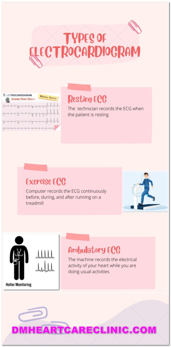 ELECTROCARDIOGRAM TEST IN TELANGANA - CARDIOLOGIST IN HYDERABAD FOR ECG ...