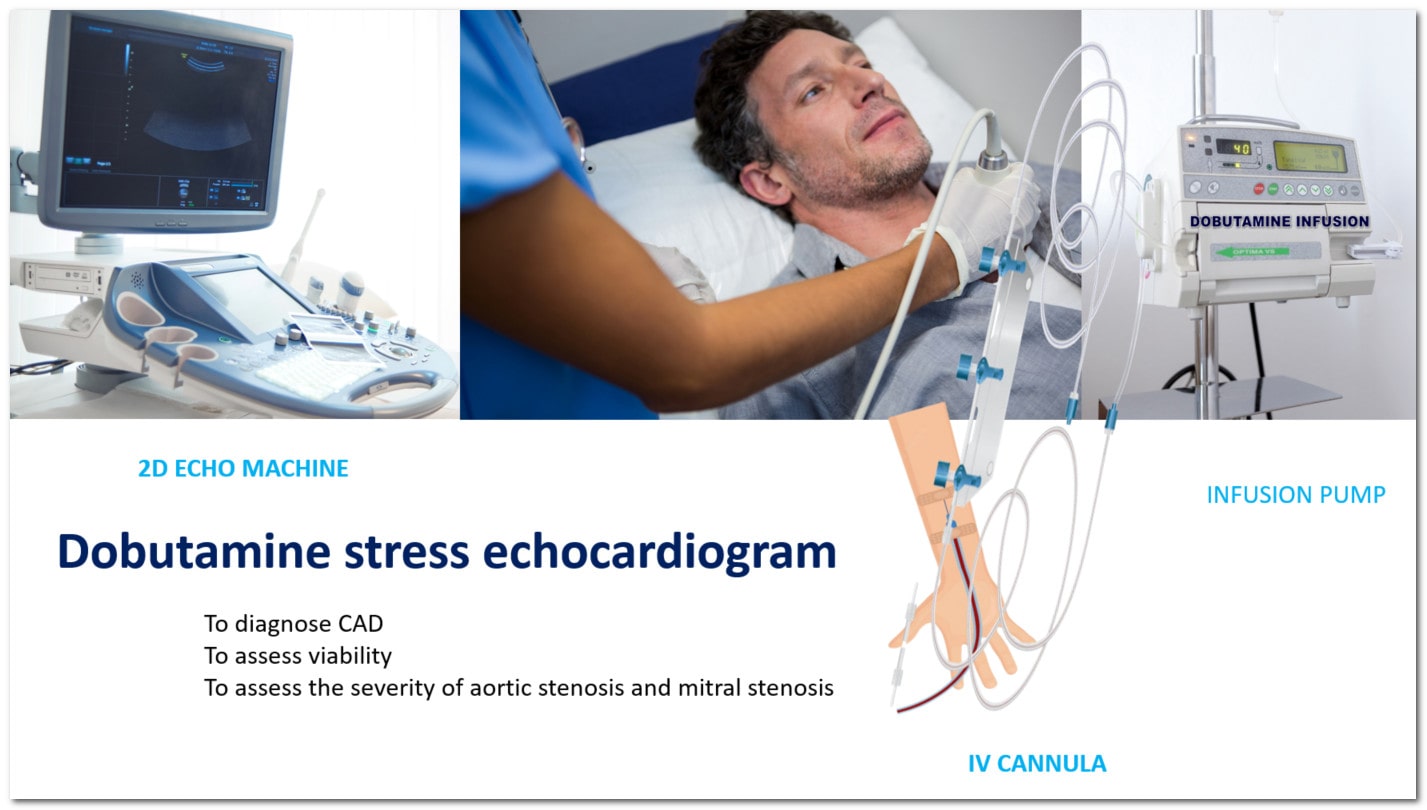 dobutamine stress echocardiogram Procedure - dobutamine infusion, image acquisition with 2d echo machine and indications