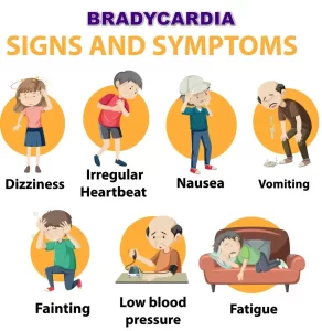 signs and symptoms of bradycardia