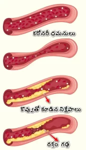 how heart attack occurs explained in Telugu