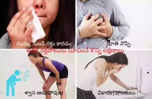 High Blood Pressure signs and symptoms in Telugu | nose bleed-chest pain-breathlessness-vomiting