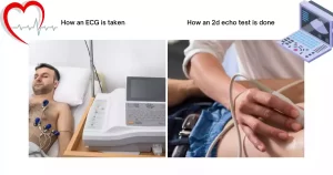 how ecg and 2d echo tests are done ?