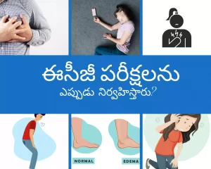 when do you need ECG test infographics in Telugu