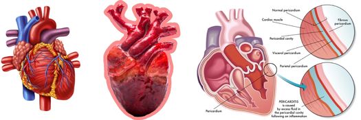 what-are-the-reasons-behind-chest-pain-in-telugu-dm-heart-care-clinic