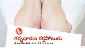 Top 10 Causes for Gestational Hypertension in Telugu - autoimmune disease