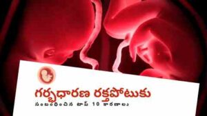 Top 10 Causes for Gestational Hypertension in Telugu - twin pregnancy